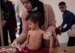 Malnourished kids in Gaza
